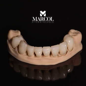 Marcol, Bydgoszcz Фото - 5