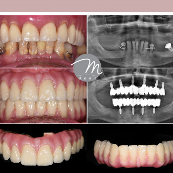 M-Dent, Wroclaw Фото - 5