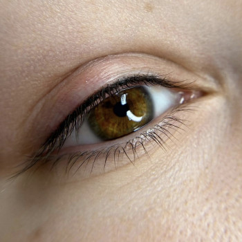 Межресничка