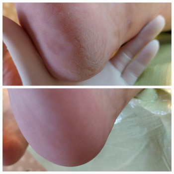 Kreator, Колобжег Фото - 5