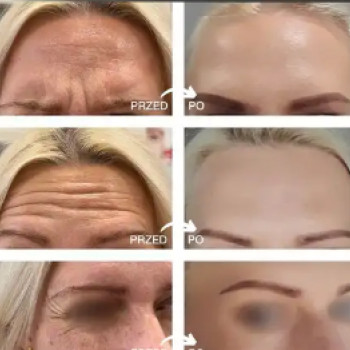 World Medica, Колобжег Фото - 5