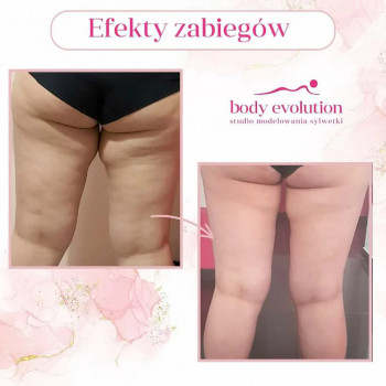 Body Evolution, Bydgoszcz Фото - 5