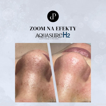 Przystan Piekna, Быдгощ Фото - 5