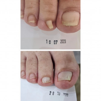 Podomania, Быдгощ Фото - 5