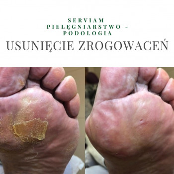 Serviam, Rybnik Фото - 5