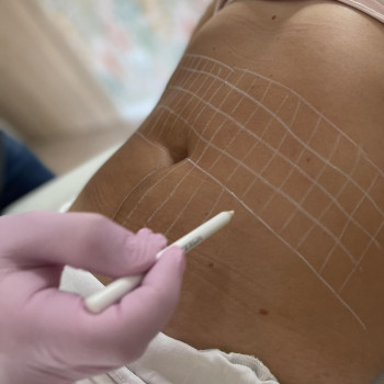 Royal Healthy Place, Sopot Фото - 5