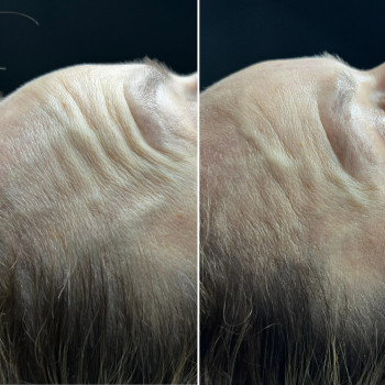 MVita, Limanowa Фото - 5