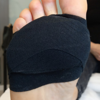 Ожег в результате нанесения пластырей и мазей от мозолей☝️