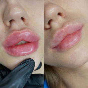 Светлана Данковцева, Voronezh Фото - 6