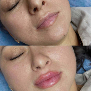 Светлана Данковцева, Voronezh Фото - 7