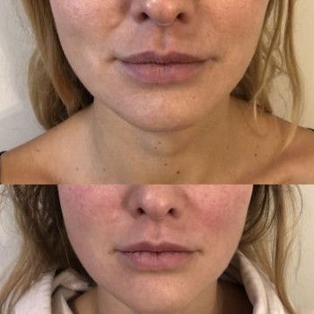 Ярослав Рубицки, Варшава Фото - 6