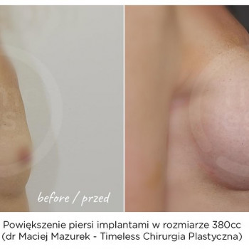 Мацей Мазурек, Варшава Фото - 5