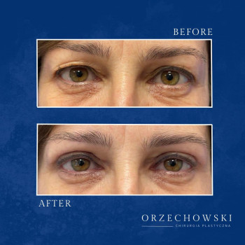 Nikol Orzechowski, Warsaw Фото - 6