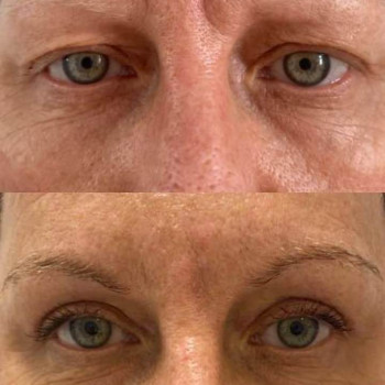 Agnieszka Bielarska, Warsaw Фото - 5