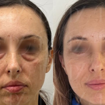 Mariusz Zagajewski, Warszawa Фото - 5