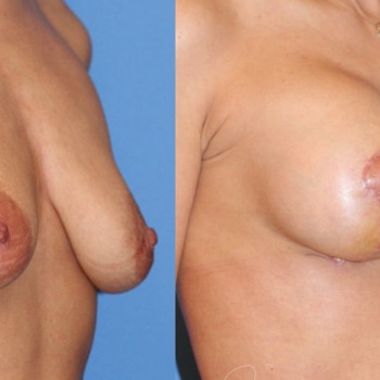 Maciej Charaziński, Warszawa Фото - 5