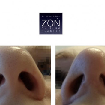 Bartłomiej Zoń, Warszawa Фото - 5