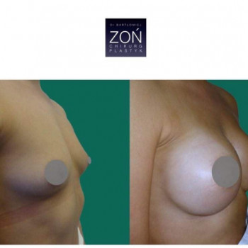 Bartłomiej Zoń, Warszawa Фото - 6