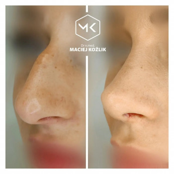 Maciej Koźlik, Warsaw Фото - 5