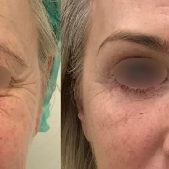 Рафал Пабьянчик, Краков Фото - 5