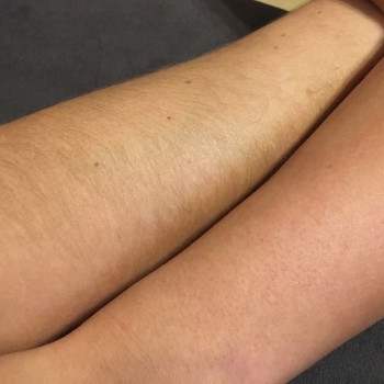 Щугаринг рук до/выше локтя или полностью.