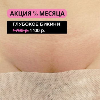 Щугаринг зоны голубого бикини.