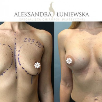 Aleksandra Łuniewska, Wrocław Фото - 5