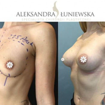 Aleksandra Łuniewska, Wrocław Фото - 6