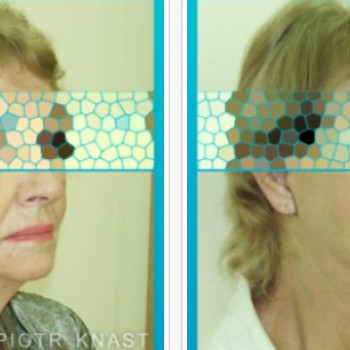 Piotr Knast, Wrocław Фото - 5