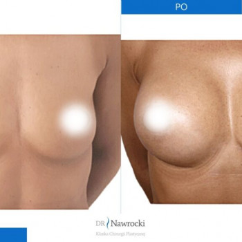 Ryszard Nawrocki, Wroclaw Фото - 5