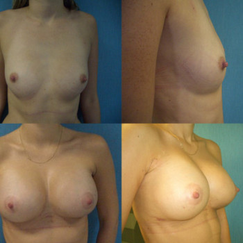 Paweł Niemkiewicz, Wrocław Фото - 5