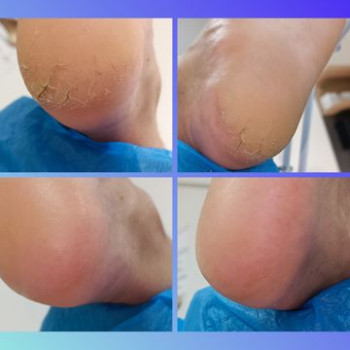 Камила Зиентек, Вроцлав Фото - 5