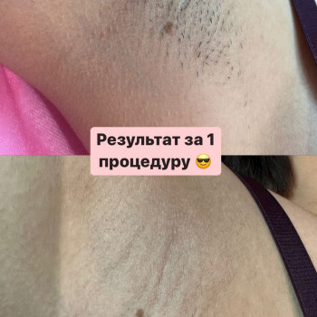 Kristina Zhychkina, Poznań Фото - 5