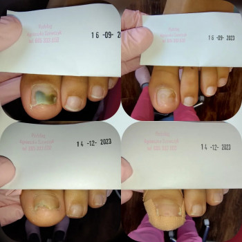 Agnieszka Szewczyk, Kraków Фото - 5