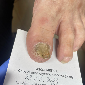 Agnieszka Dzikowska, Krakow Фото - 5