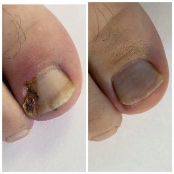 Центр Лечения Стопы , Moscow Фото - 5