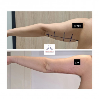 Joanna Jędrys, Krakow Фото - 5