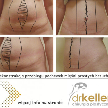 Малгожата Келлер, Краков Фото - 5