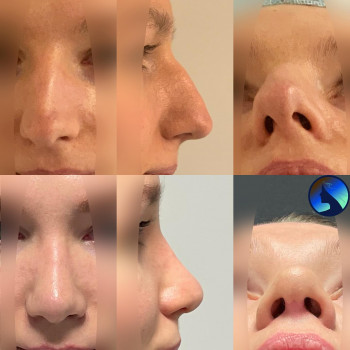 Dominik Boligłowa, Krakow Фото - 5