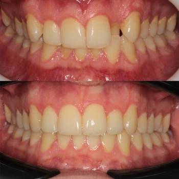 Bartosz Staniak, Poznan Фото - 5