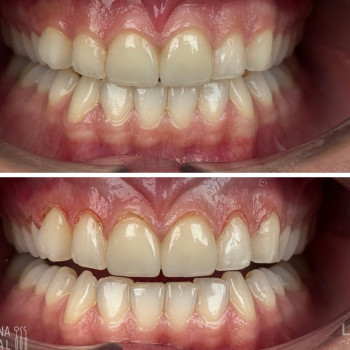 Tomasz Materna, Poznan Фото - 5