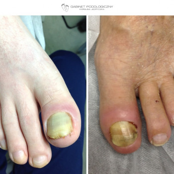 Karolina Jędryczka, Poznan Фото - 5