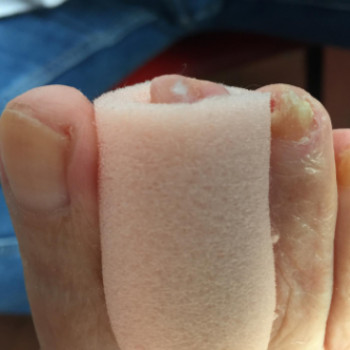 Agnieszka Hentschel-Walszewska, Poznan Фото - 6