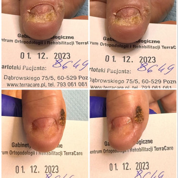 Jan Głodowski, Poznan Фото - 5