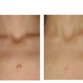 Magdalena Szymańska-Bueno, Poznan Фото - 5