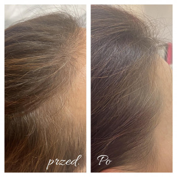 Aleksandra Banach, Warsaw Фото - 5