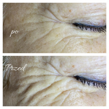 Aleksandra Banach, Warsaw Фото - 6