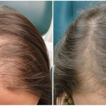 Anna Bonisławska, Warszawa Фото - 5