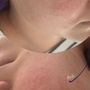 Emilia Szczepanska, Wrocław Фото - 5