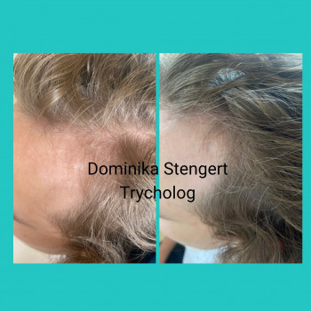 Dominika Stengert, Poznan Фото - 5